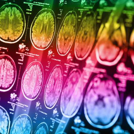 The X-ray of the human brain closeup imageの写真素材