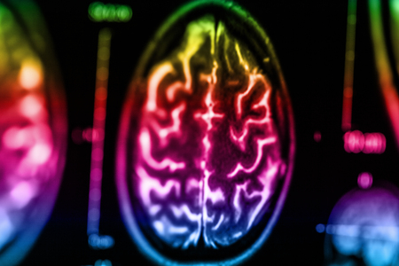 The X-ray of the human brain closeup image