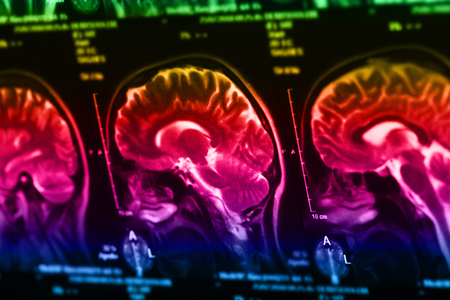 The X-ray of the human brain closeup imageの写真素材