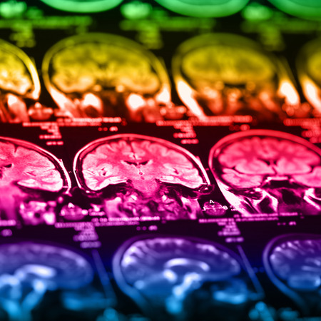 The X-ray of the human brain closeup imageの写真素材
