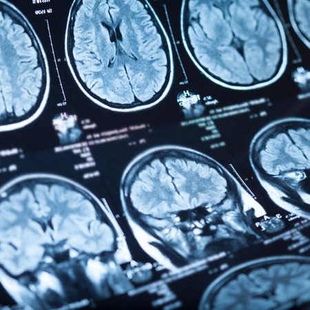 The X-ray of the human brain closeup imageの写真素材