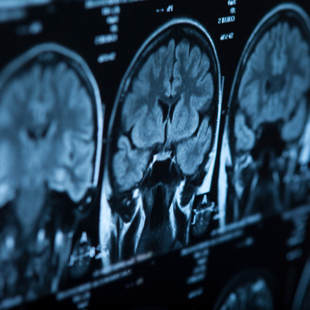 The X-ray of the human brain closeup imageの写真素材