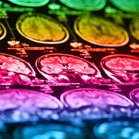 The X-ray of the human brain closeup imageの写真素材