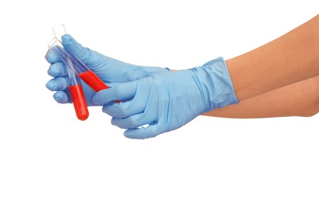 Doctor will be carry out research a samples of bloods at inhabitants of coast of Alabama-Louisiana...
