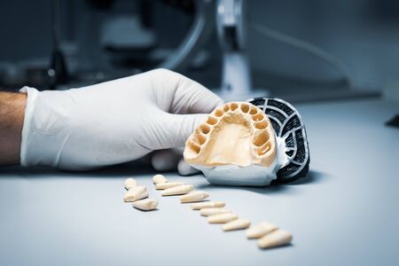 orthodontic prosthesis at laboratory.の写真素材