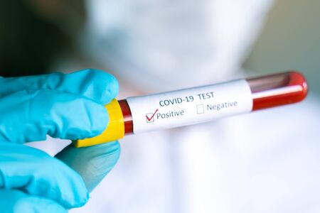 Hand in blue glove holding Test vial with Sample blood test of Coronavirus (Covid-19), Coronavirus...