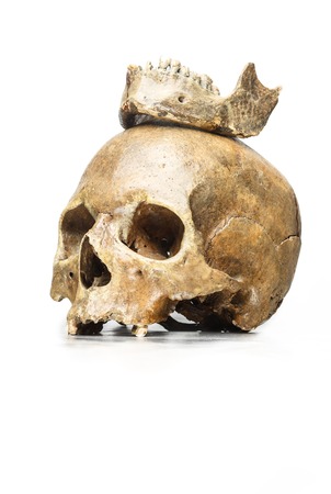skull Queen with a crown of jawの写真素材
