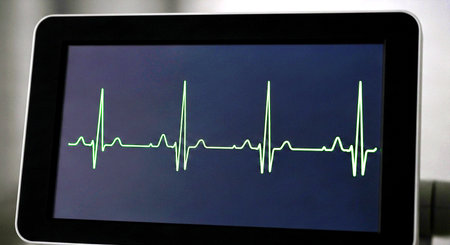 Electrocardiogram on a digital display in a hospital.の素材
