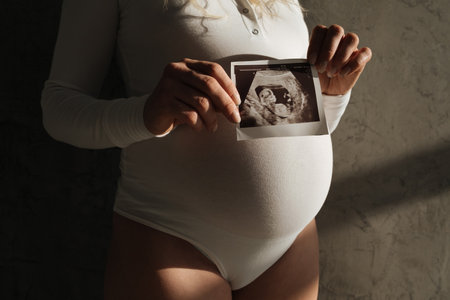The belly of a pregnant girl in a white bodysuit close-up. Ultrasound scan in a hand. beautiful natural lightの写真素材