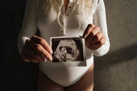 The belly of a pregnant girl in a white bodysuit close-up. Ultrasound scan in a hand. beautiful natural lightの写真素材