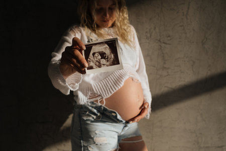 Portrait of a pregnant girl with an ultrasound scan in her hands. beautiful natural lightの写真素材