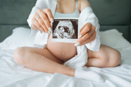 The pregnant girl holding an ultrasound picture in her hands while sitting on the bedの写真素材