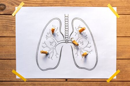 drawn human lungs with extinguished and crushed cigarettes, stop smoking, quit smoking, do not smoke.の写真素材