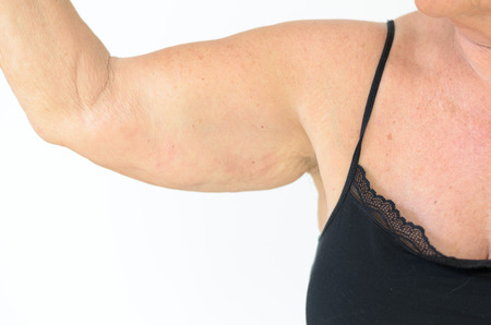 Senior woman wearing black laced bra while showing flabby arm, effect of aging caused by loss of elasticity and muscleの写真素材