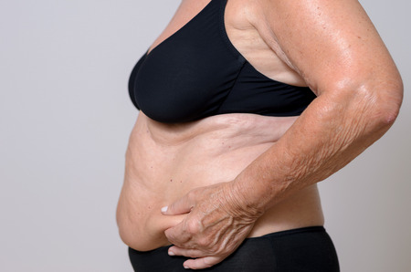 Elderly overweight lady pinching her excess fat at the side of her stomach between her fingers as she poses in profile in her bra and panties, close up midriff view on greyの写真素材