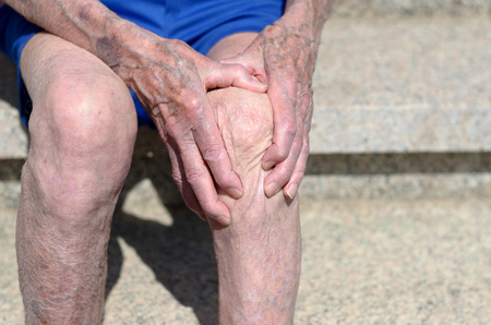 Old man with gnarled hands with pronounced veins clutching his knee as he sits outdoors on a stone bench in a close up view of the ageing processの写真素材