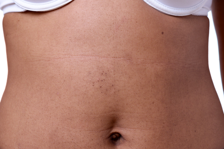 Close up view of dark-skinned woman bare bellyの写真素材