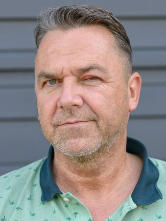 Portrait of an unshaven middle-aged man with eye infection in his left eye showing a swollen inflamed upper eyelid from a bacterial infectionの写真素材