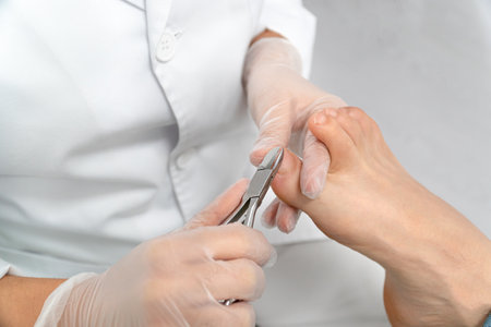 Close up of a chiropodist's hands doing chiropody in her podiatry clinic. The chiropodist is cutting...