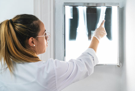Young doctor examining a leg X-ray and pointing out a part of it. The X-ray is in the illuminated screenの写真素材