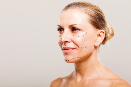 middle aged woman getting ready for plastic surgery