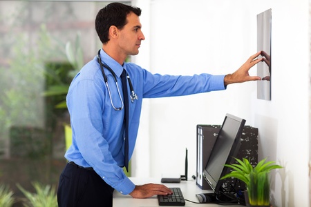 medical doctor studying patient's x-ray in officeの写真素材
