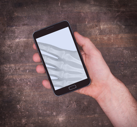 Smartphone display showing an x-ray of the hand holding itの写真素材