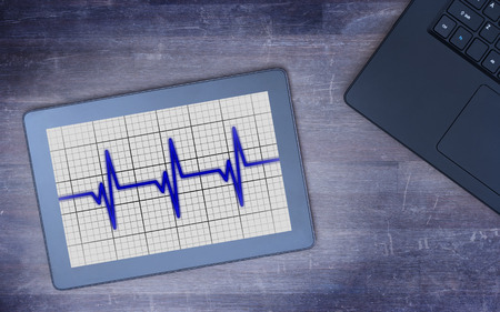 Electrocardiogram on a tablet - Concept of healthcare, heartbeat shown on monitor - blueの写真素材