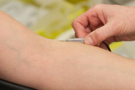 Donor in an armchair donates blood at hemotransfusion station, inserting the needleの写真素材