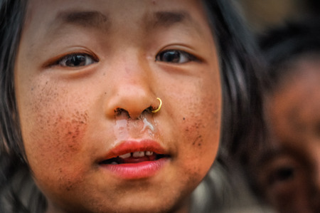 Dolpo, Nepal - circa May 2012: Small brown-eyed girl with piercing in her nose and dirt on cheeks in Dolpo, Nepal. Documentary editorial.のeditorial素材