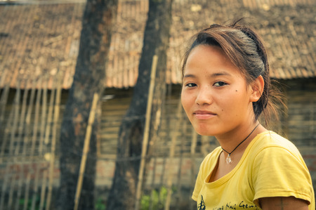 Damak, Nepal - circa May 2012: Brown-haired girl in yellow t-shirt and with simple necklace at Nepali refugee camp in Damak, Nepal. Documentary editorial.のeditorial素材