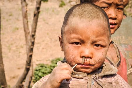 Dolpo, Nepal - circa May 2012: Young brown-eyed boy in brown clothes with dirt on his face has lollipop in his mouth in Dolpo, Nepal. Documentary editorial.のeditorial素材