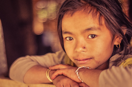 Kanchenjunga Trek, Nepal - circa April 2012: Young girl with brown eyes and small scar on her nose with head on her hands in Kanchenjunga Trek, Nepal. Documentary editorial.のeditorial素材
