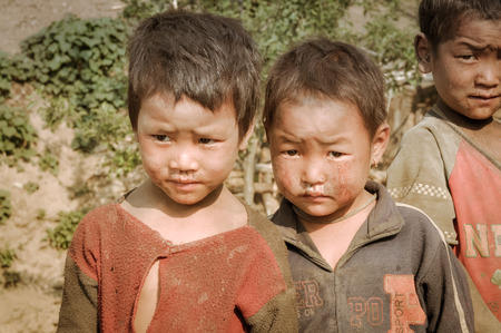 Dolpo, Nepal - circa May 2012: Brown-haired girl and two boys pose and frown to photocamera with dirt on their faces and clothes in Dolpo, Nepal. Documentary editorial.のeditorial素材