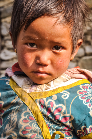 Beni, Nepal - circa May 2012: Small girl with short brown hair and brown eyes wears earrings and blue and yellow jacket and looks up in Beni, Nepal. Documentary editorial.のeditorial素材