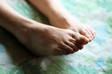 Close-up of the feet of an elderly woman lying on a nursing bedの写真素材
