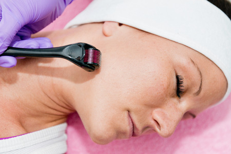 Treating skin with dermal rollerの写真素材