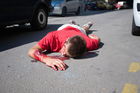 Pedestrian killed by car lying on the streetの写真素材