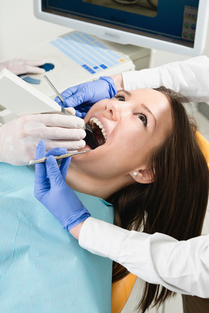 Ceramic tooth reconstruction procedure - Dentists using 3D intraoral camera to create model for veneerの写真素材