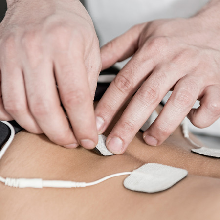 Placing electrodes for transcutaneous electrical nerve stimulation or TENS