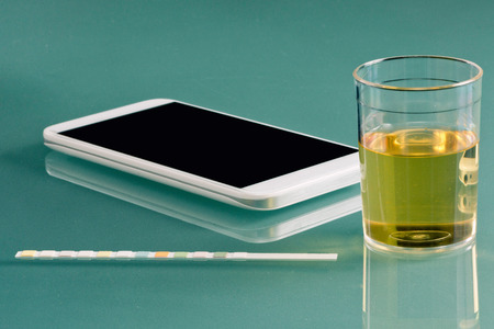 Personal urine testing kit - urine sample, test strip, smart phone with healthcare appの写真素材