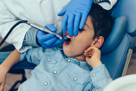 Dentist Removing Dental Calculus to Little Boyの写真素材