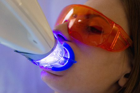 Laser teeth whitening treatmentの写真素材