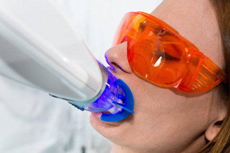 Teeth whitening procedureの写真素材