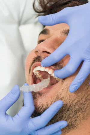 Orthodontist placing invisible braces in patient's mouthの写真素材