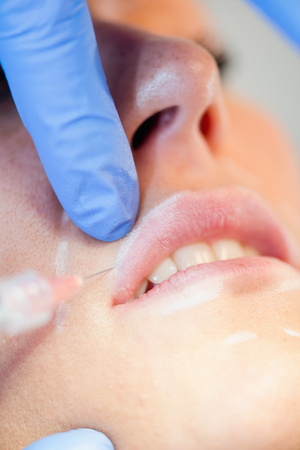 Hyaluronic acid lip treatment. Detailed macro image, focus set on needle tipの写真素材