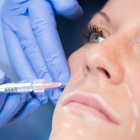 Hyaluronic acid injection. Focus set on syringe and needleの写真素材