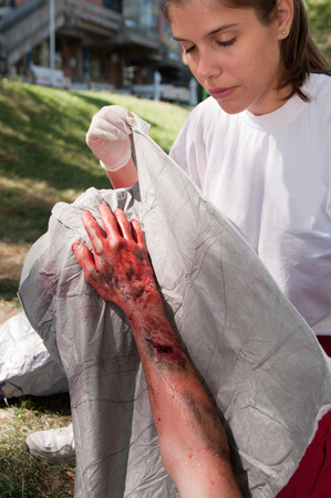 Paramedic treating a victim with third degree burns. Simulated exercise, professional SFX make-up.の写真素材