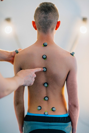 Placing reflective marking balls for posture analysisの写真素材