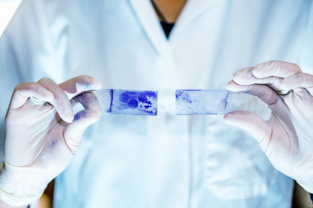 Microbiology laboratory work, comparing resultsの写真素材